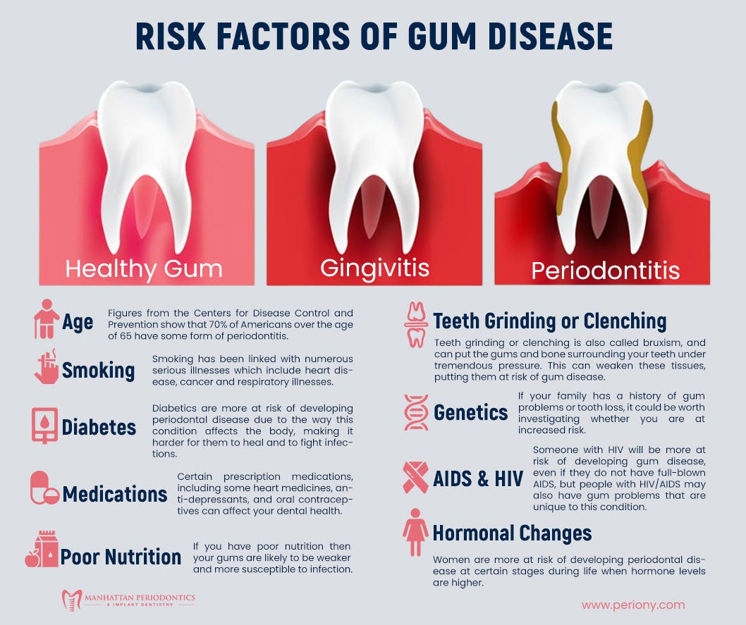 Risk Factors of Gum Disease.jpg