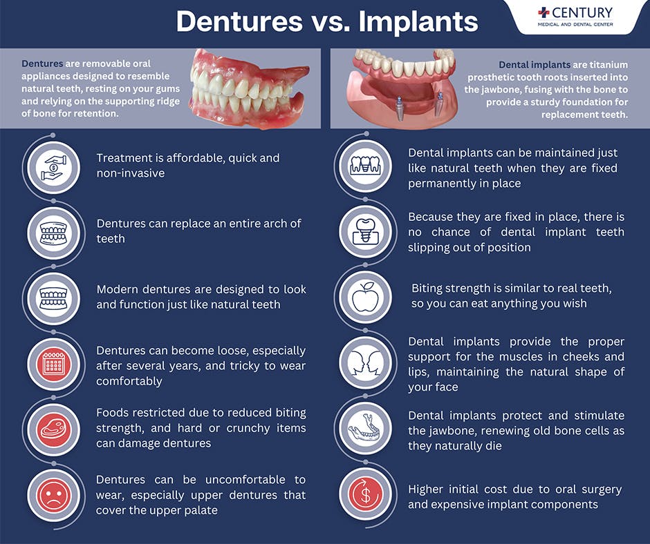 dentures-vs-implants.jpg