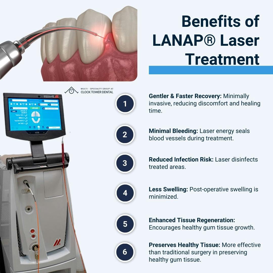 benefits-of-LANAP-laser-treatment.jpg