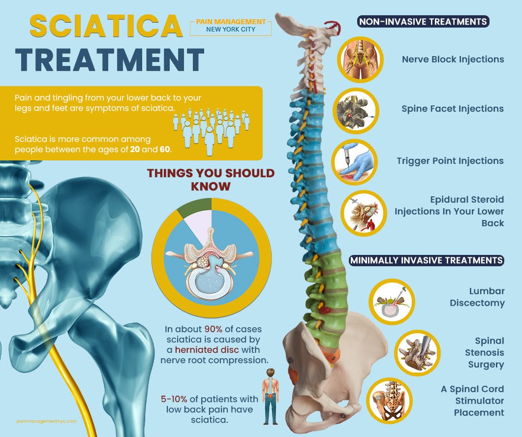 Sciatica Treatment.jpg