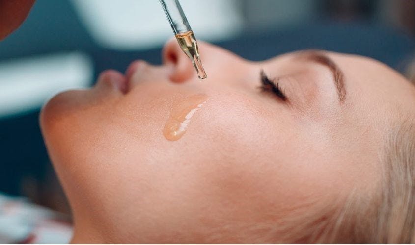 Dùng trực tiếp tinh dầu trà trị mụn