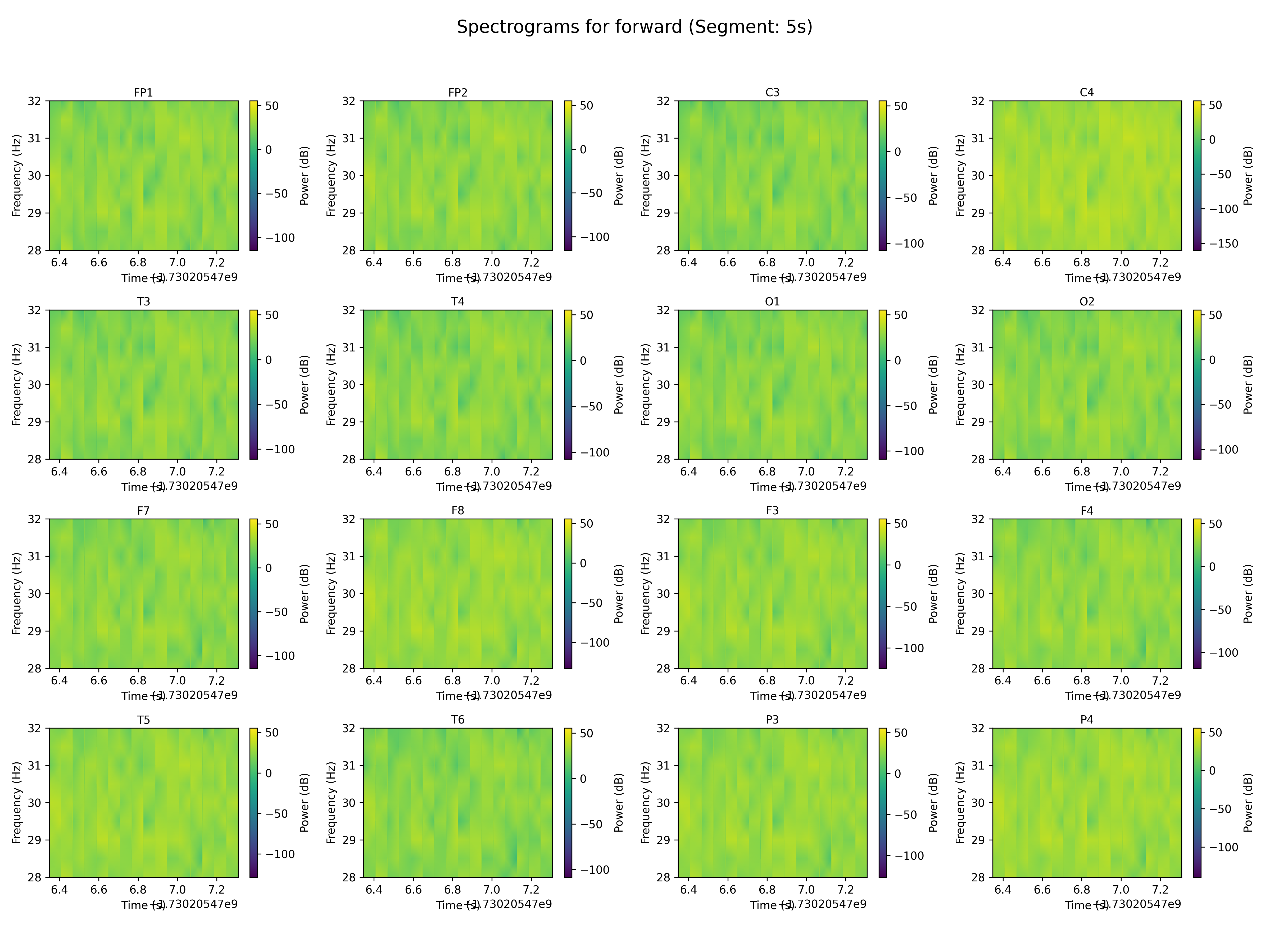 spectrogram_forward_segment_5s.png