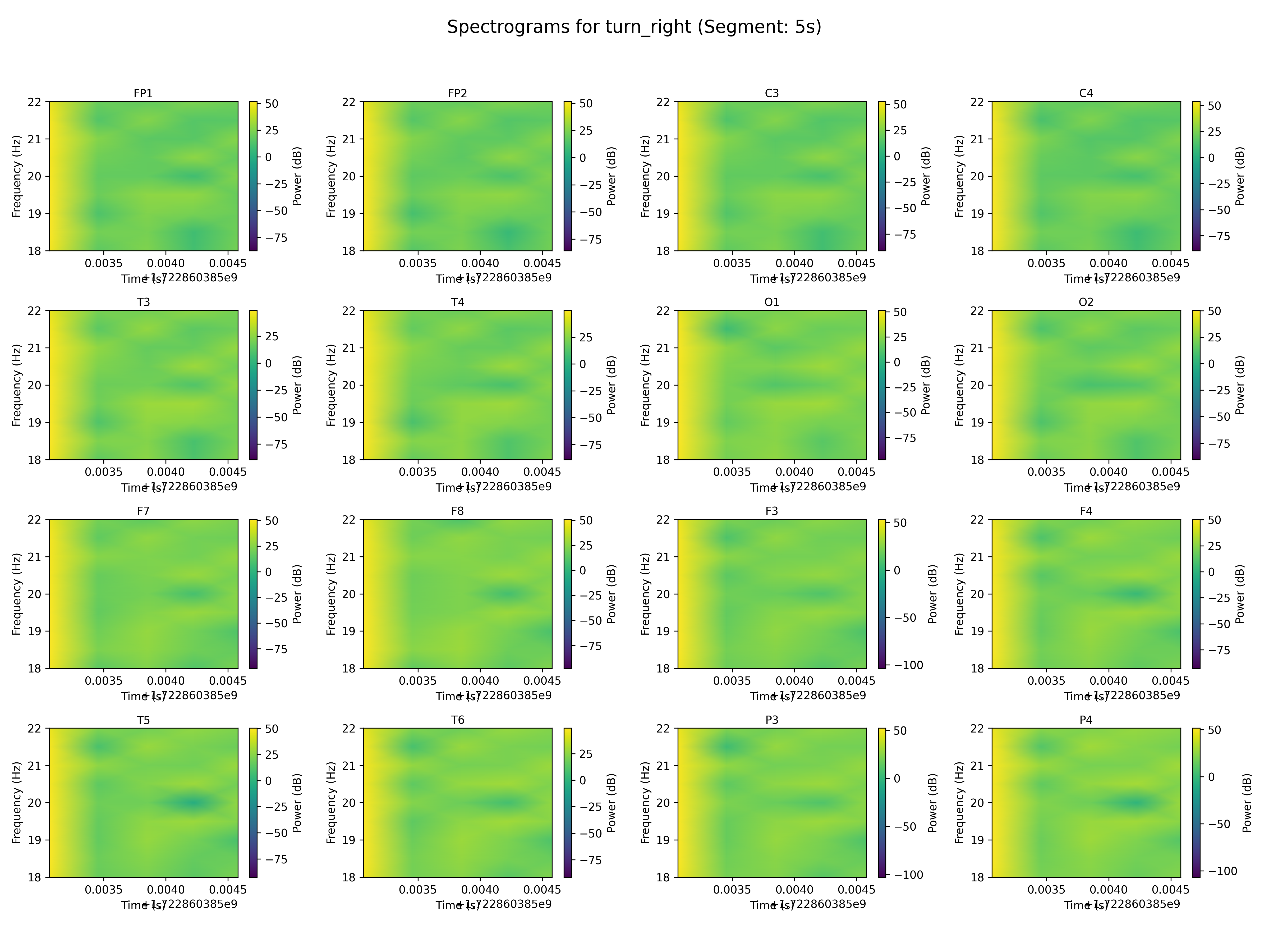 spectrogram_turn_right_segment_5s.png