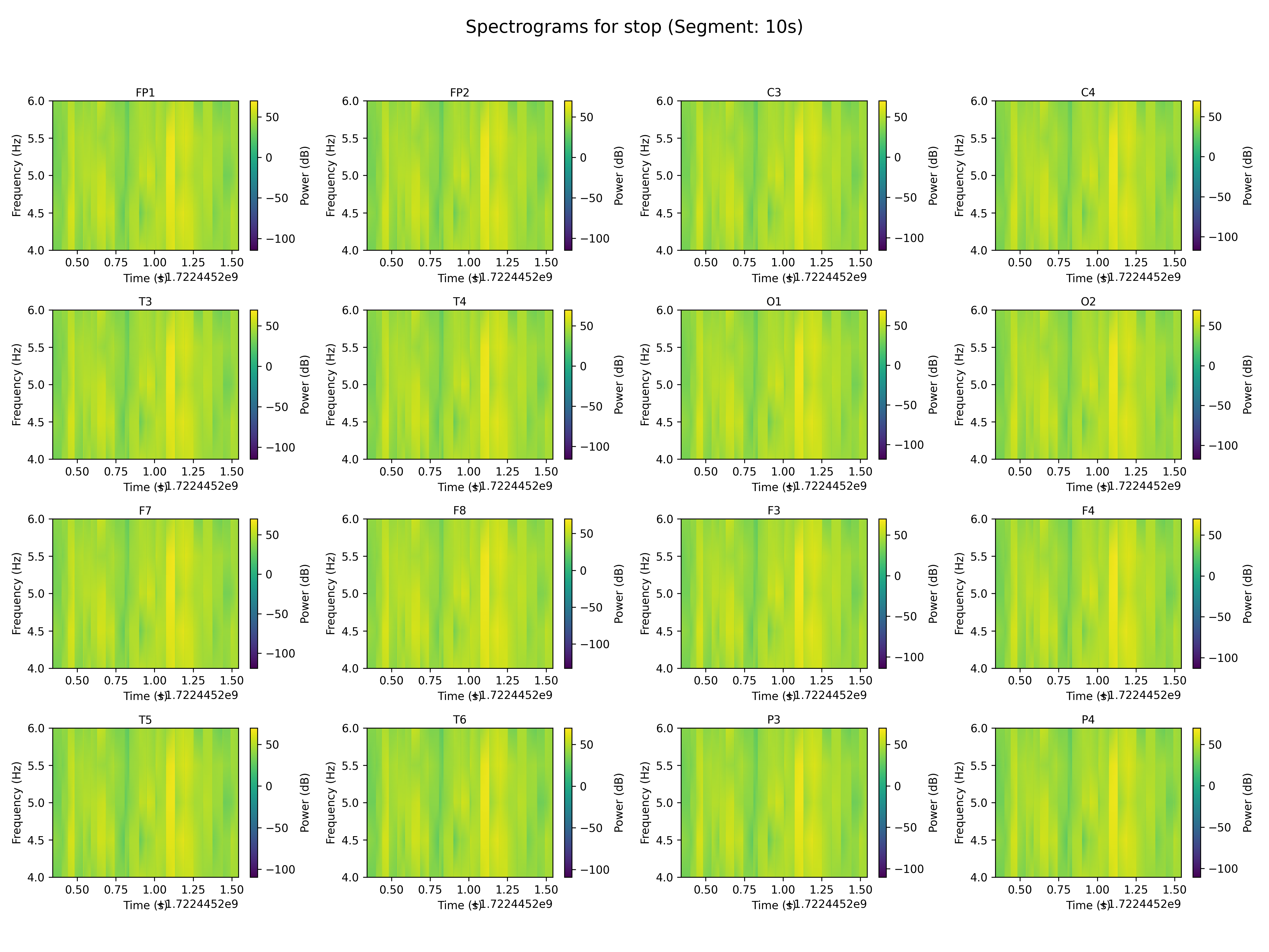 spectrogram_stop_segment_10s.png