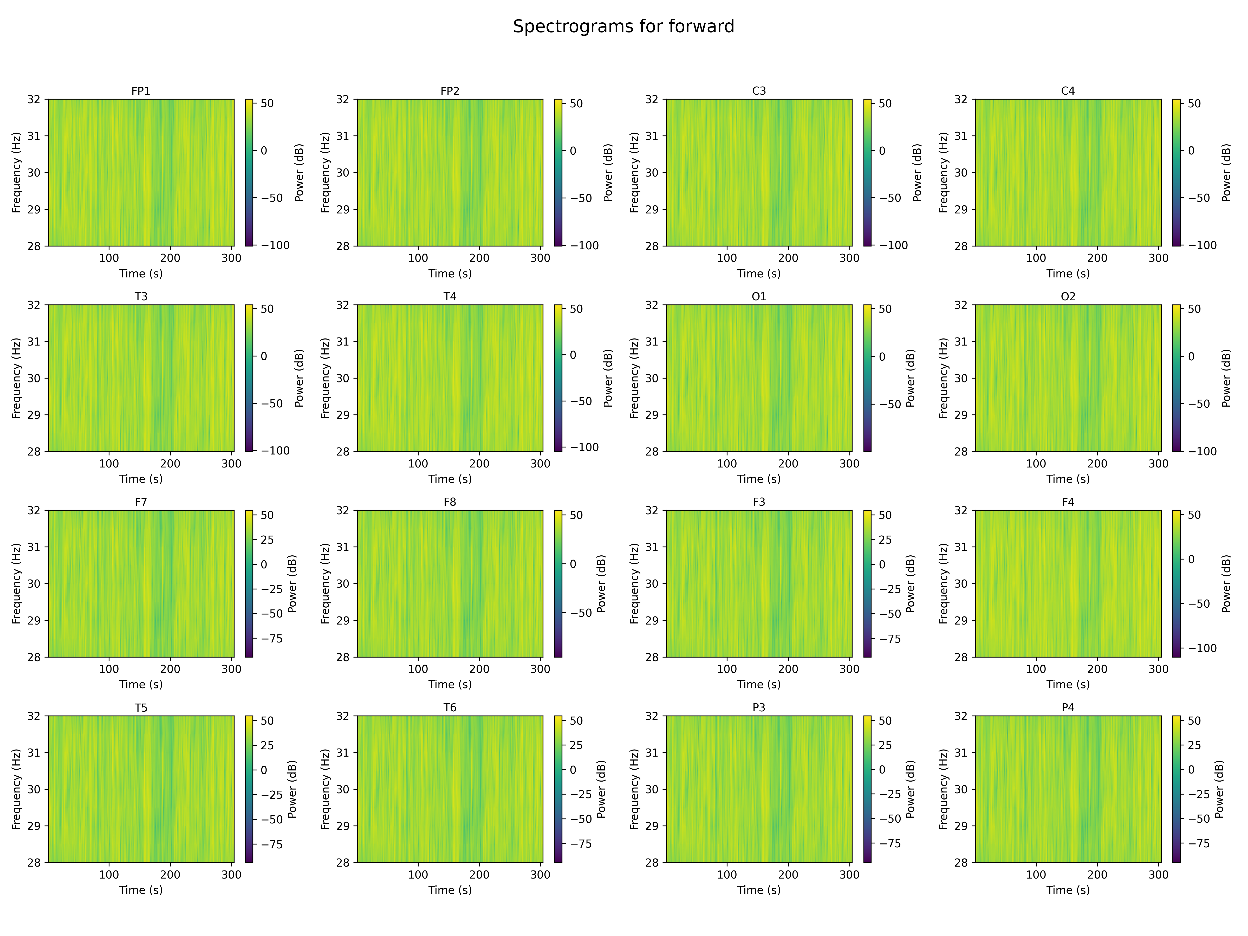 spectrogram_forward_channels.png