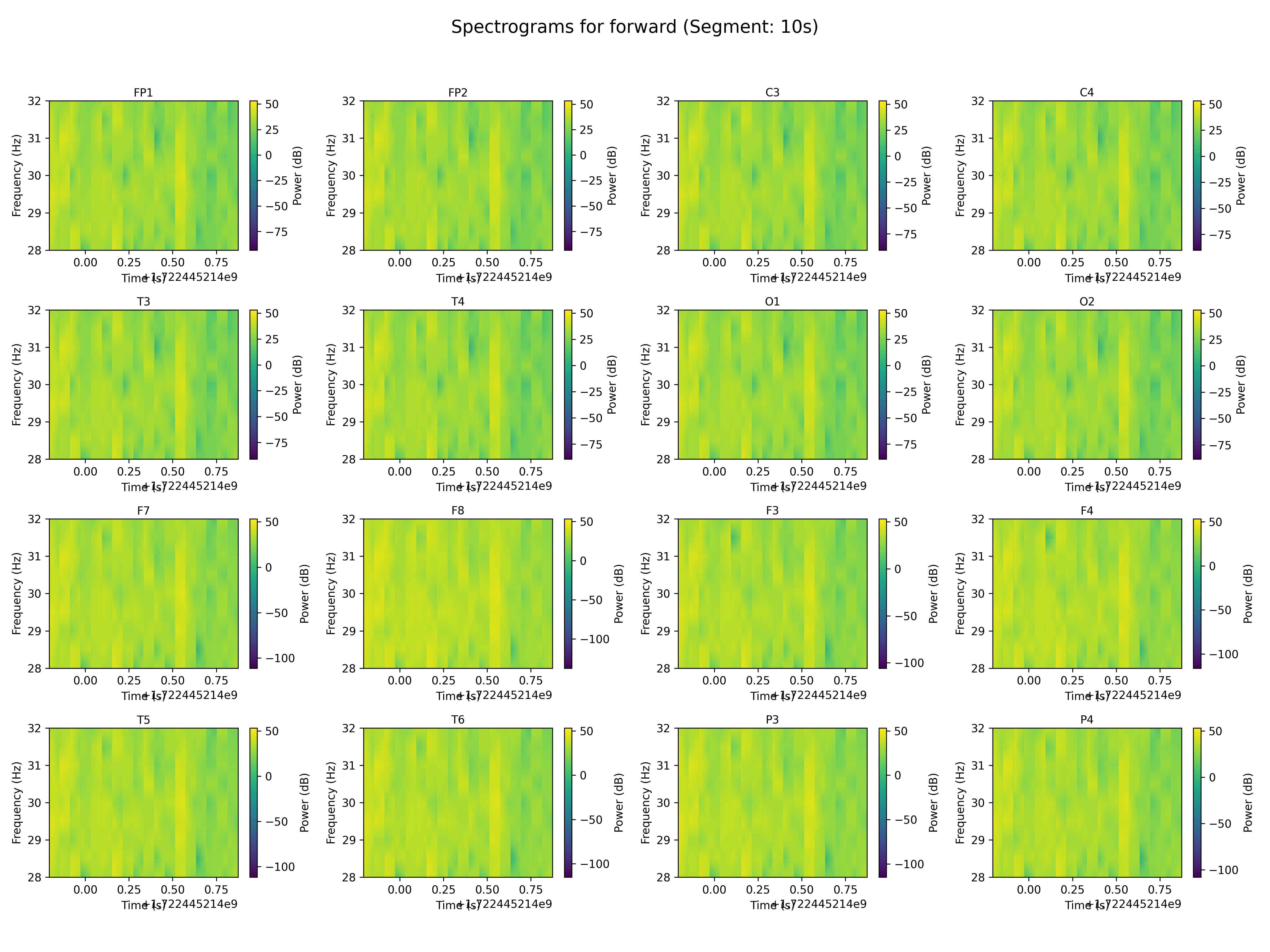 spectrogram_forward_segment_10s.png