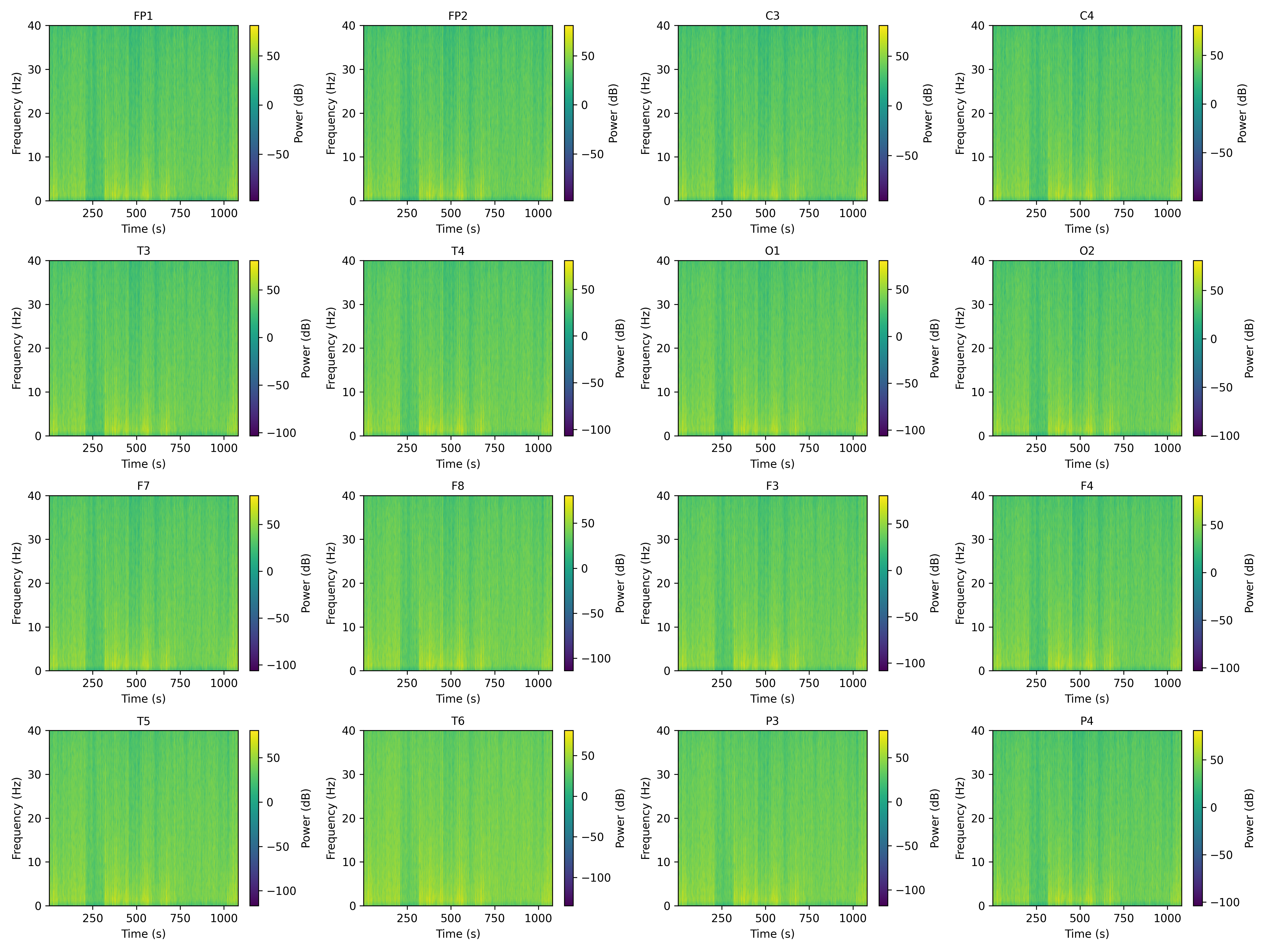 spectrogram_all_channels.png