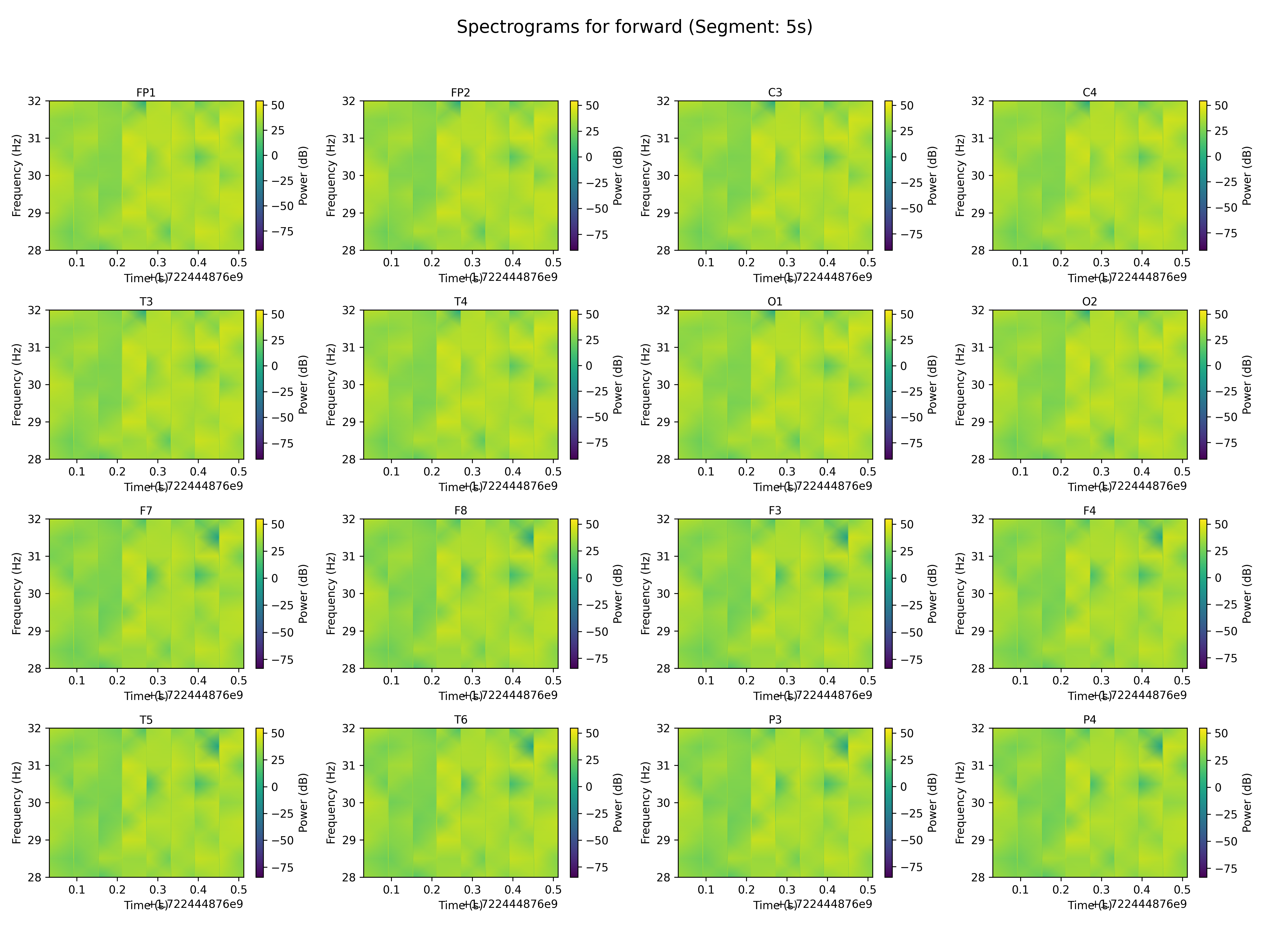 spectrogram_forward_segment_5s.png