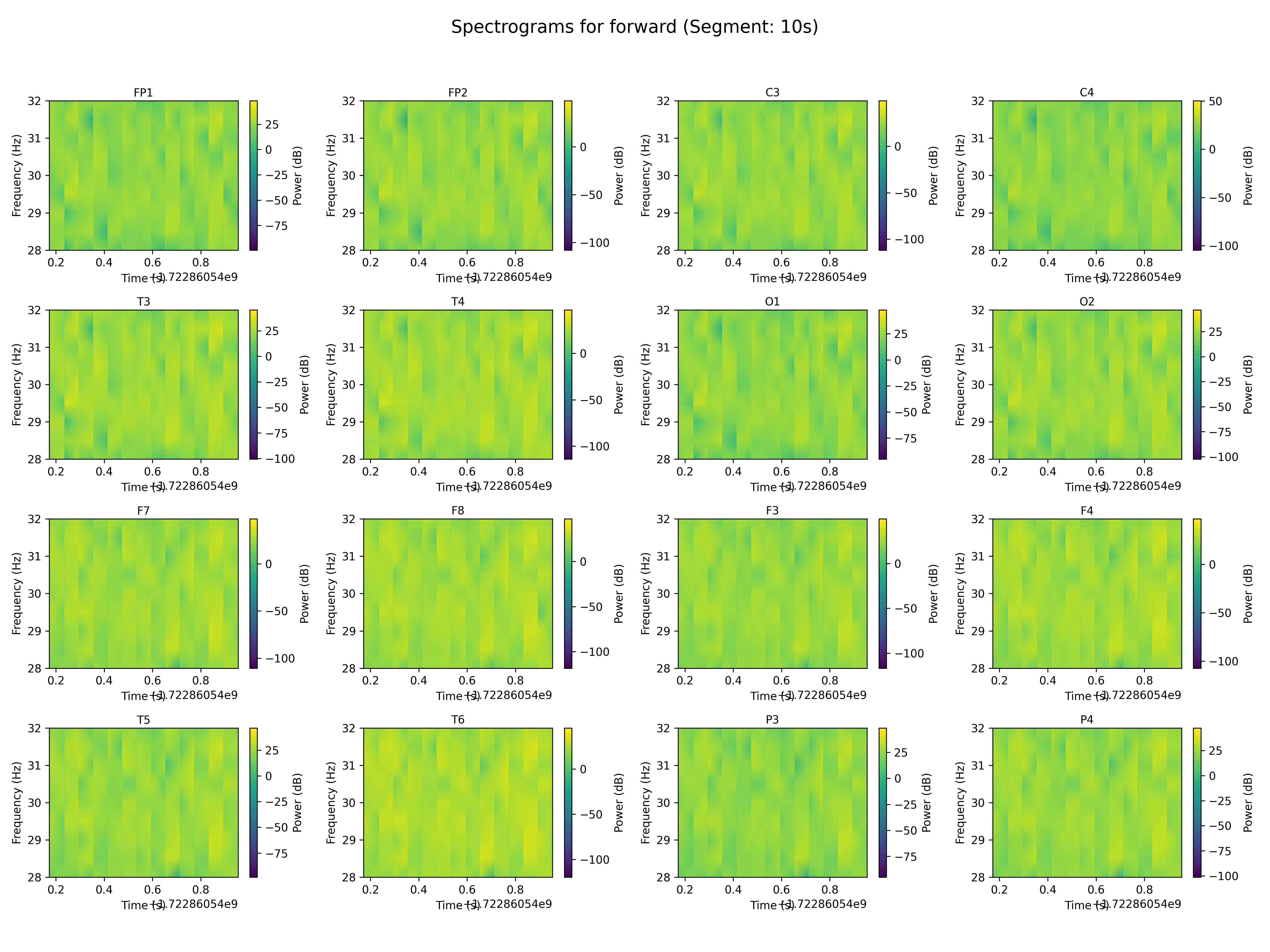 spectrogram_forward_segment_10s.png