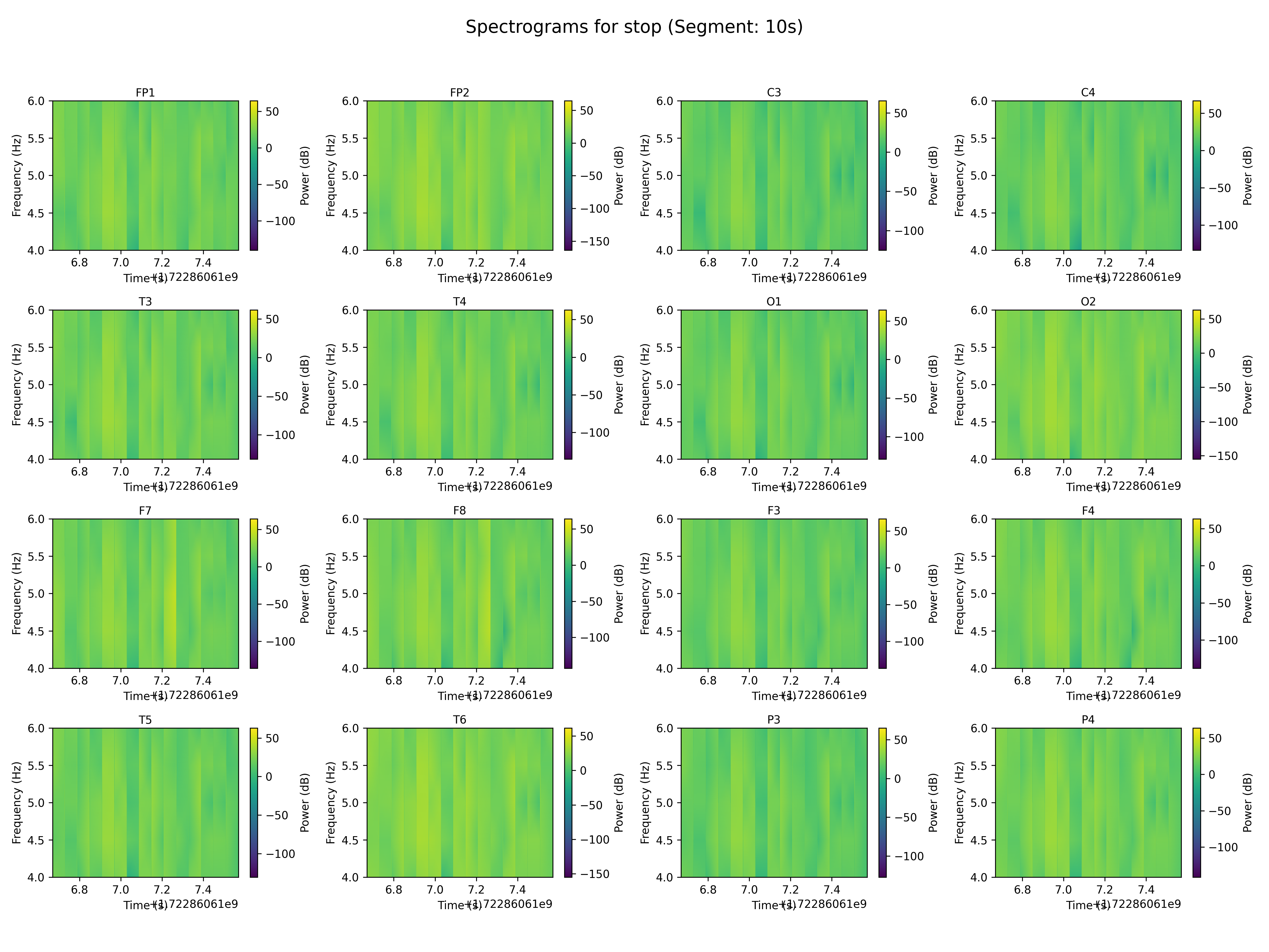 spectrogram_stop_segment_10s.png