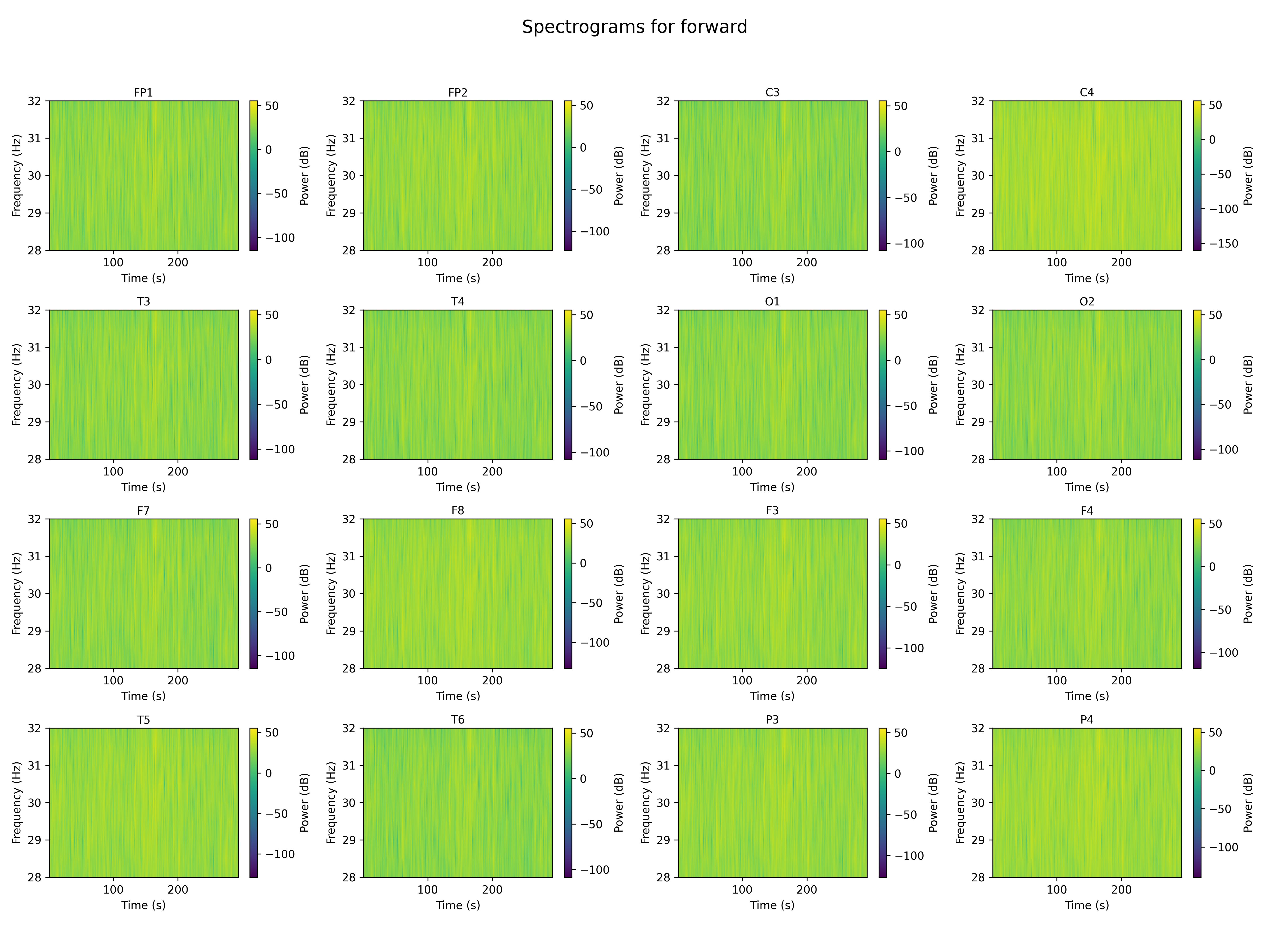 spectrogram_forward_channels.png