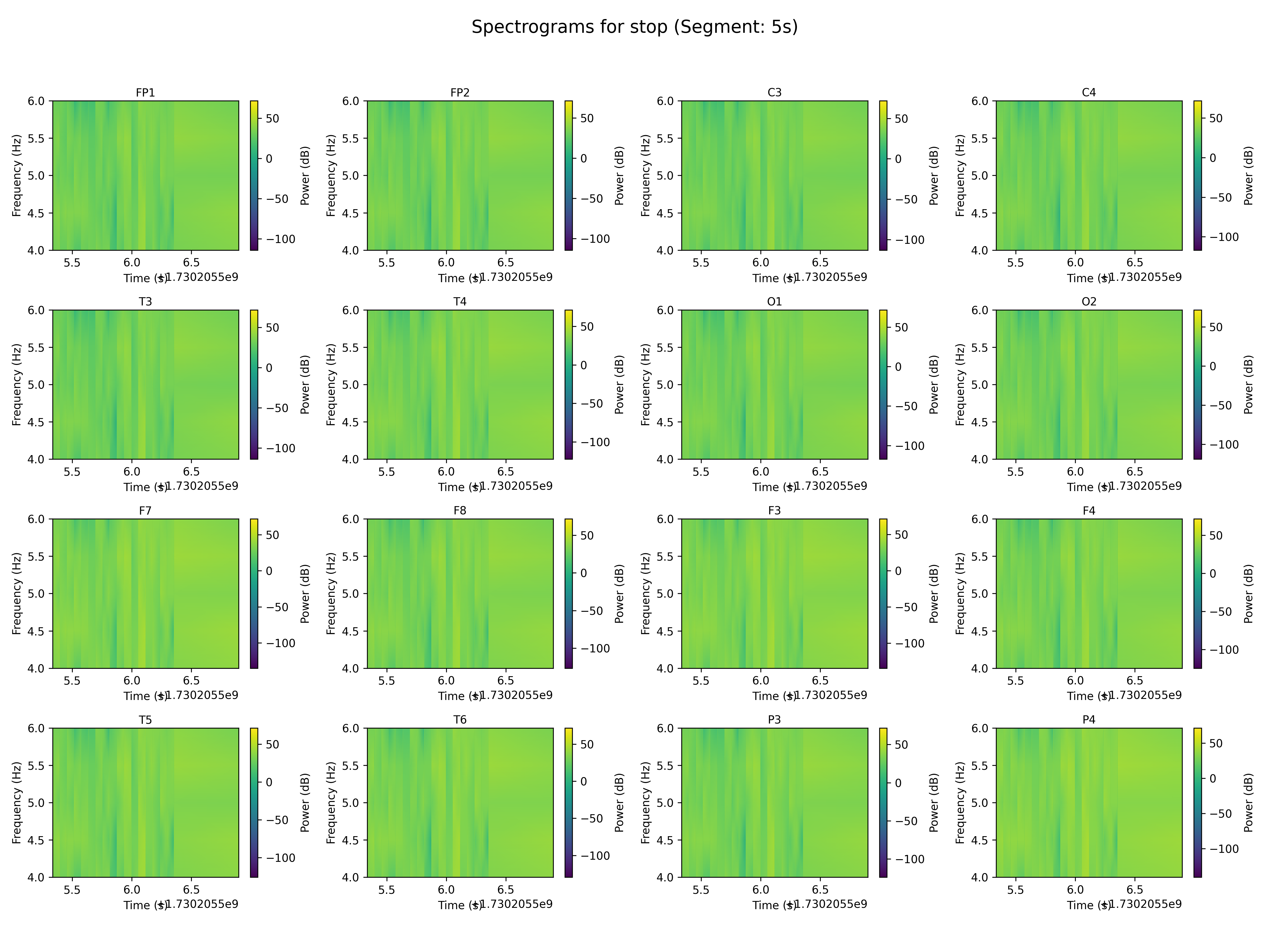 spectrogram_stop_segment_5s.png