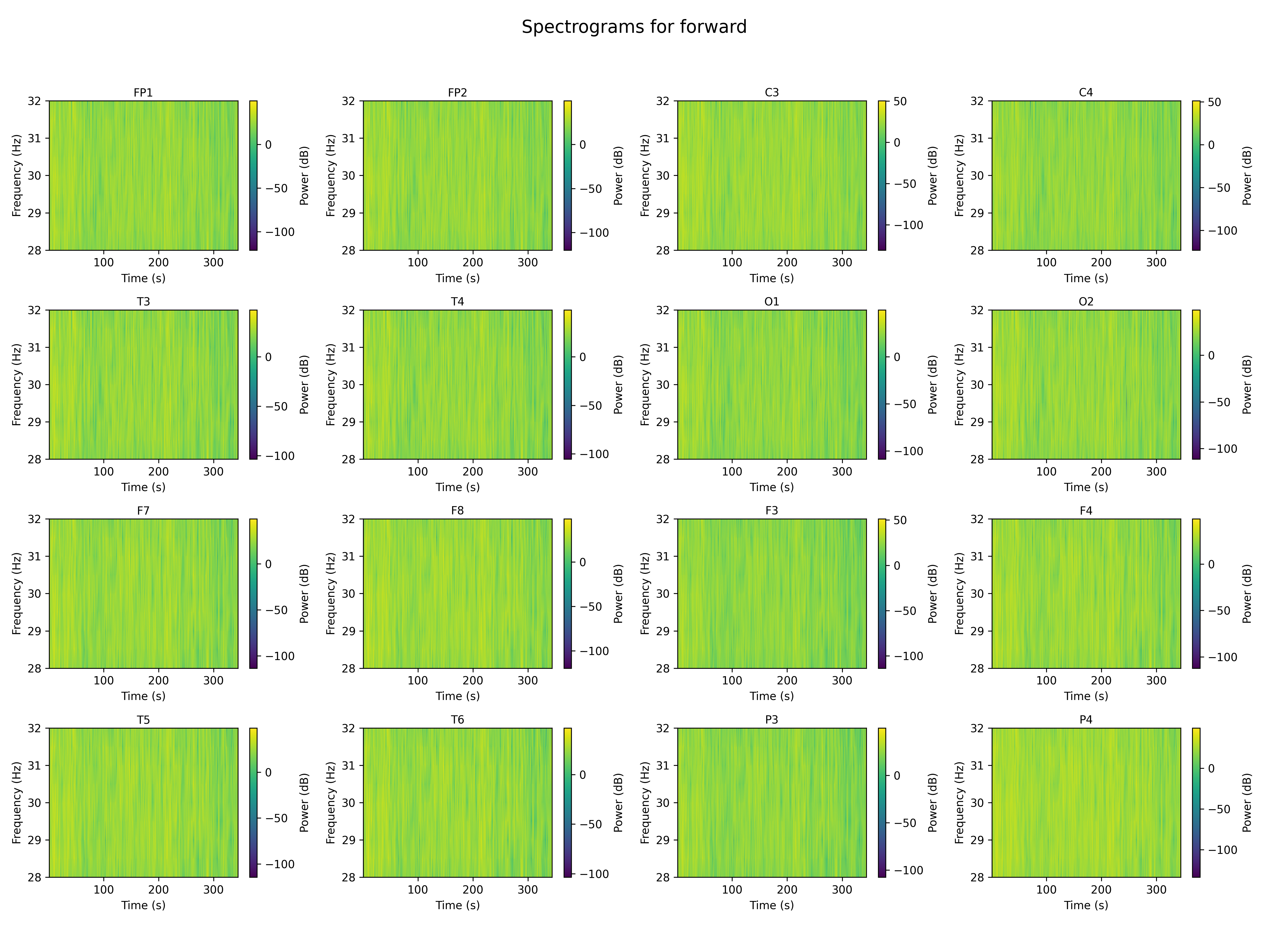 spectrogram_forward_channels.png