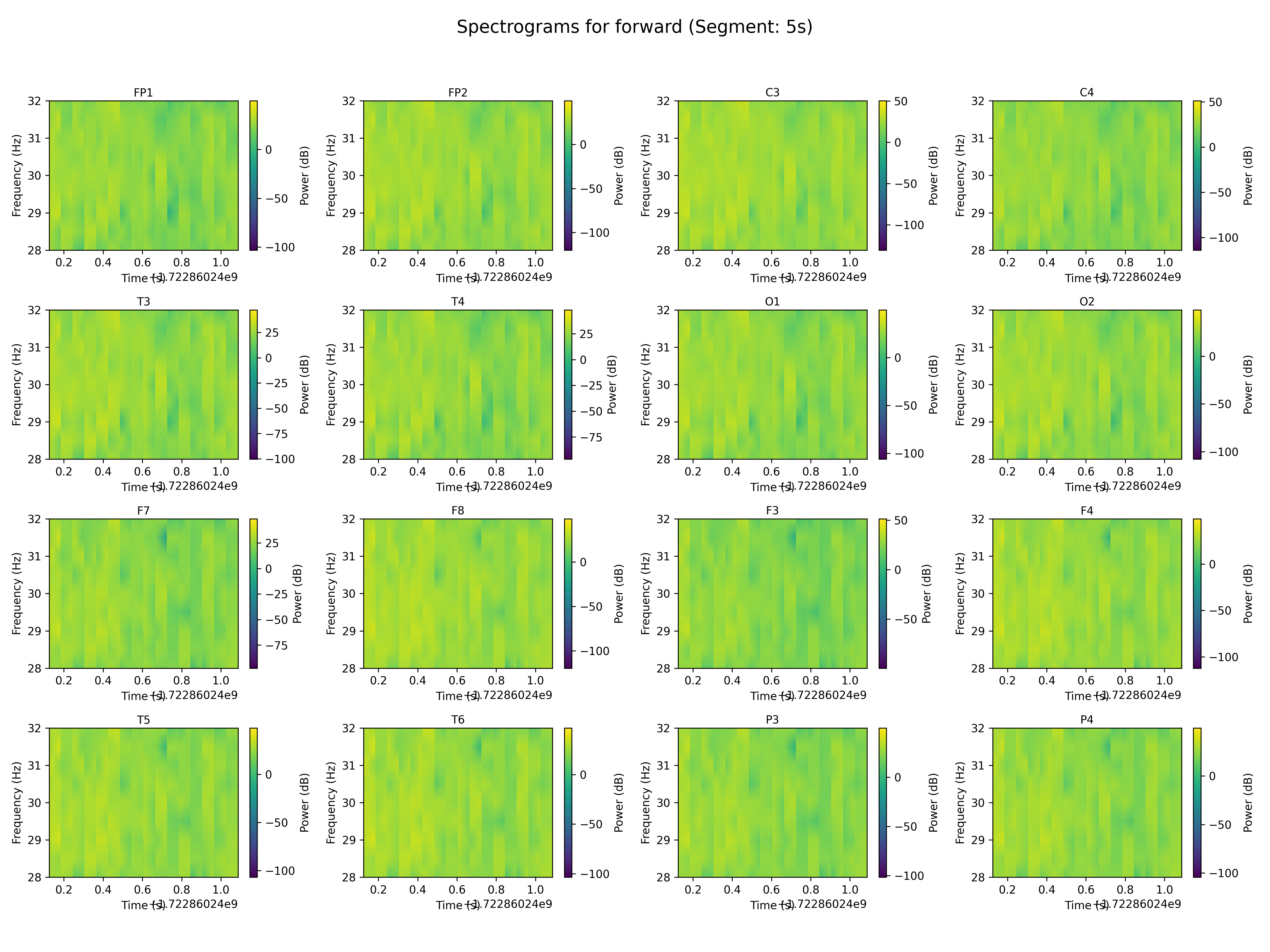 spectrogram_forward_segment_5s.png