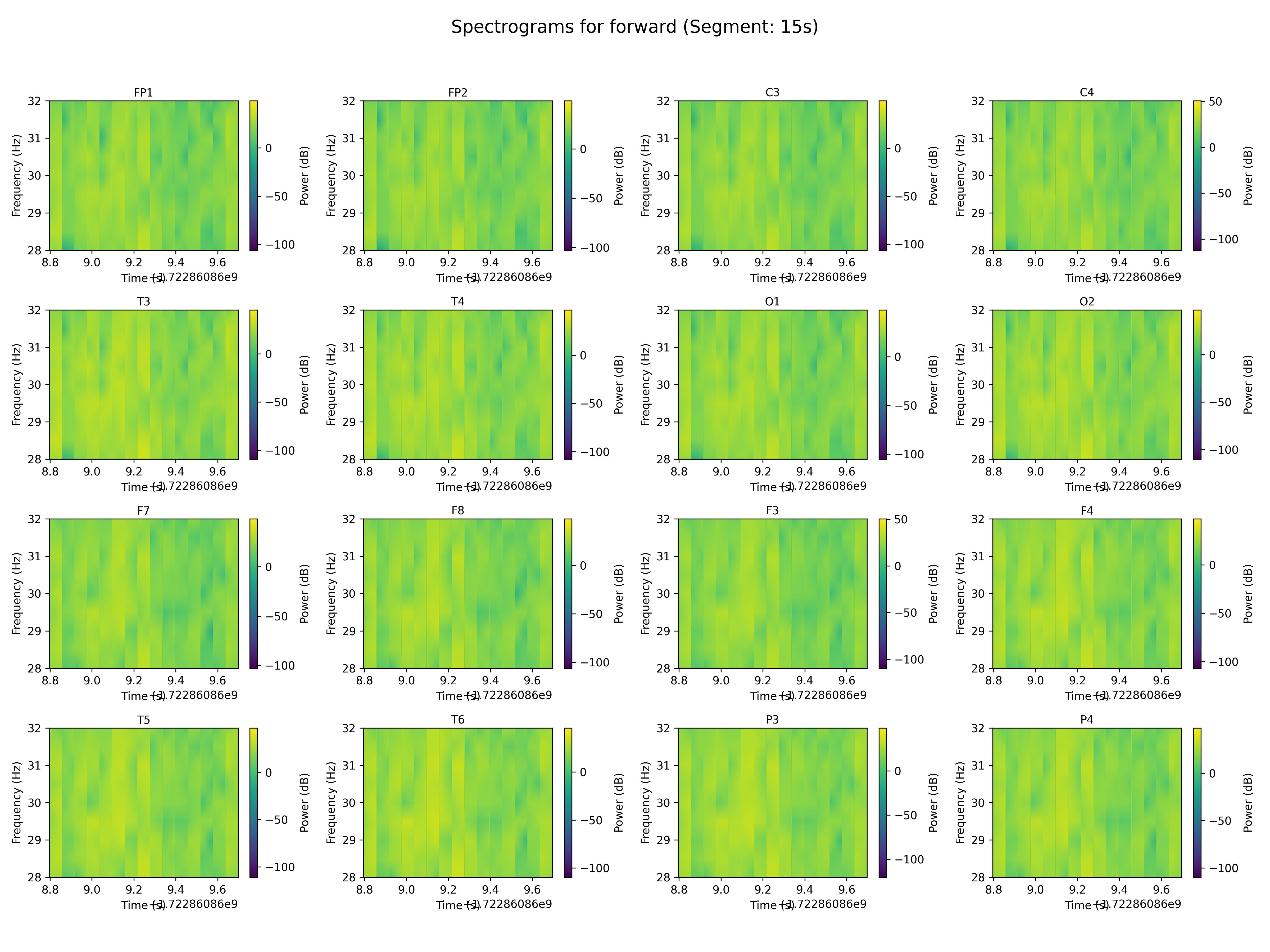 spectrogram_forward_segment_15s.png