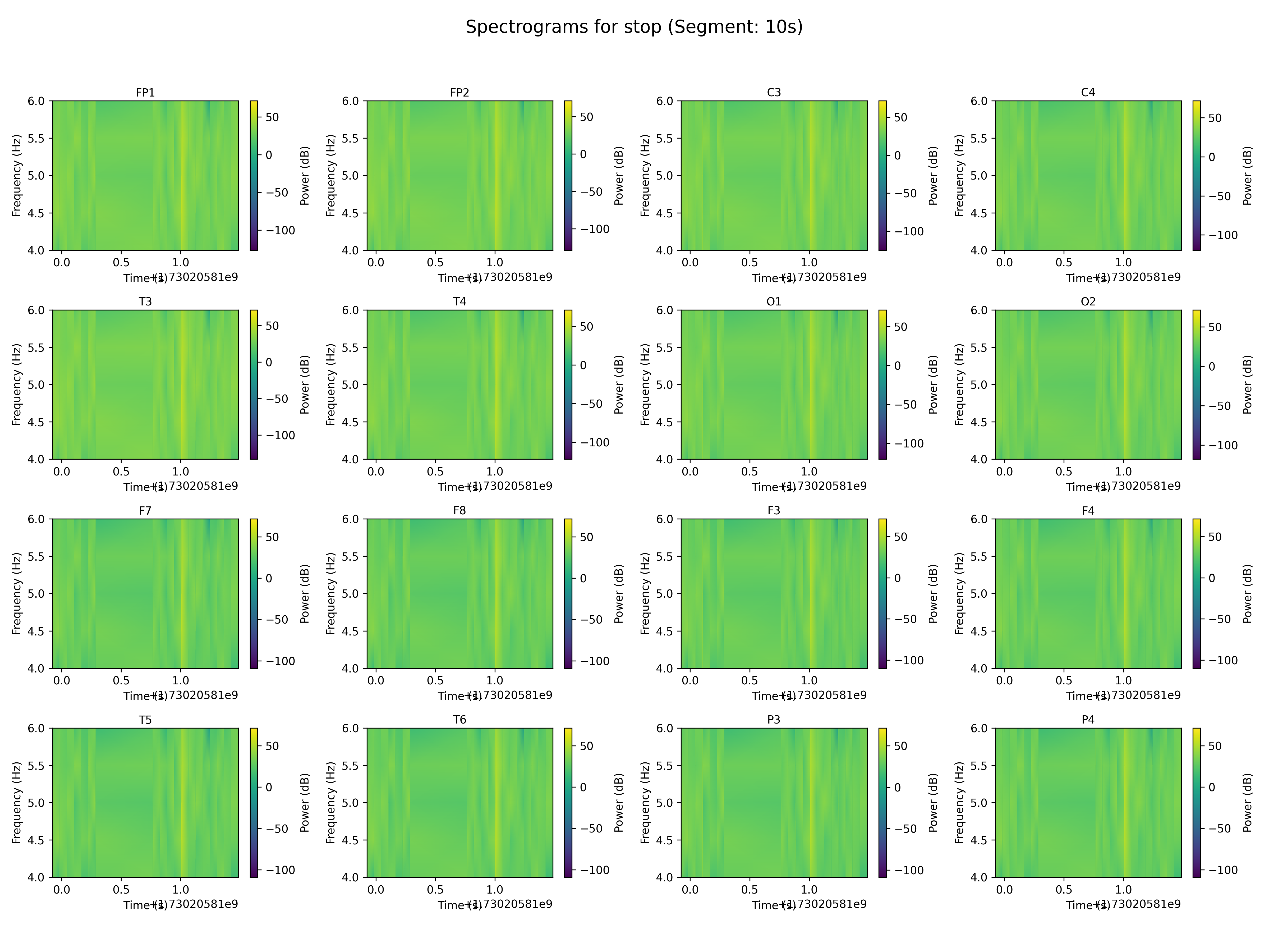 spectrogram_stop_segment_10s.png