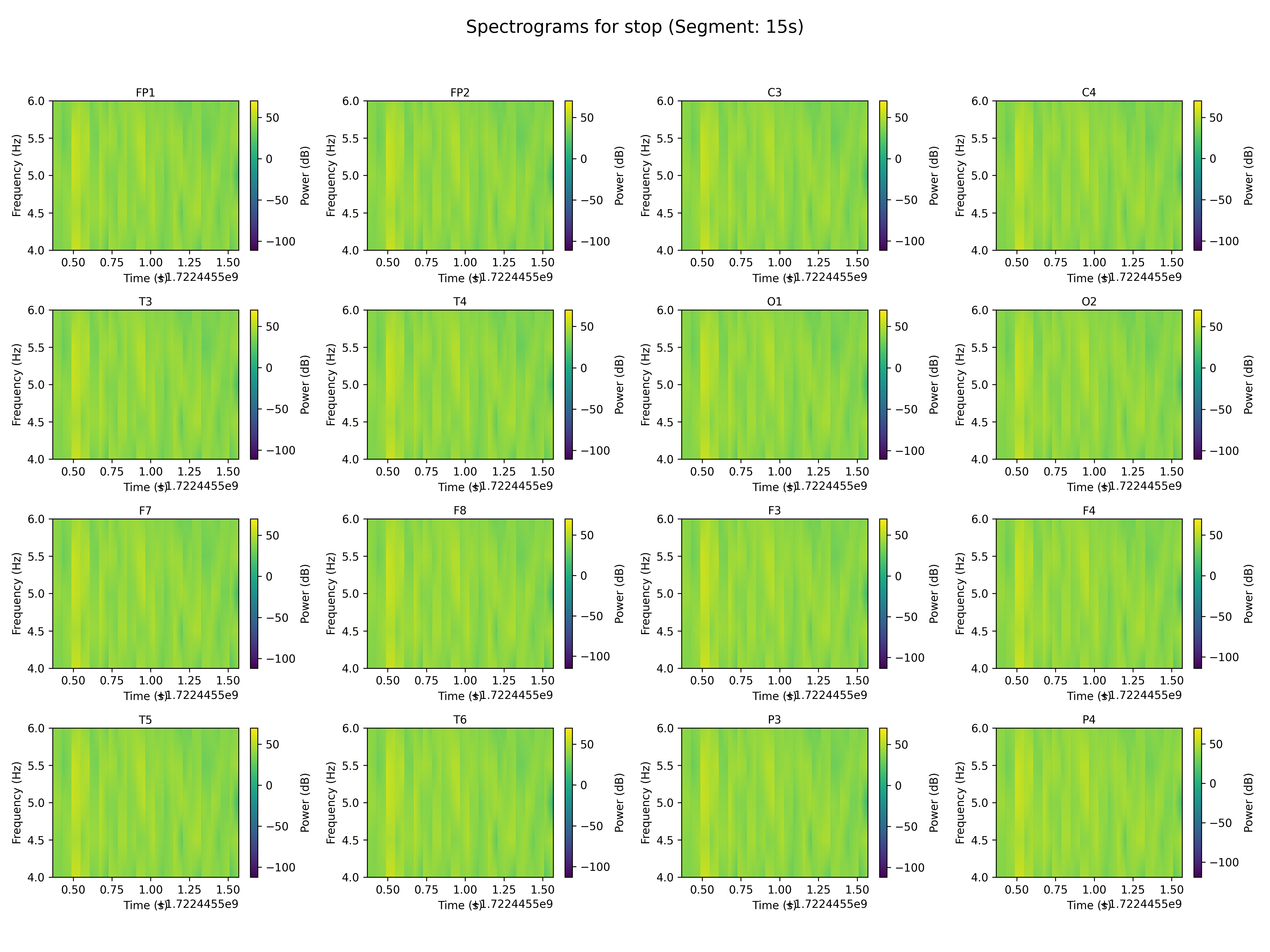 spectrogram_stop_segment_15s.png