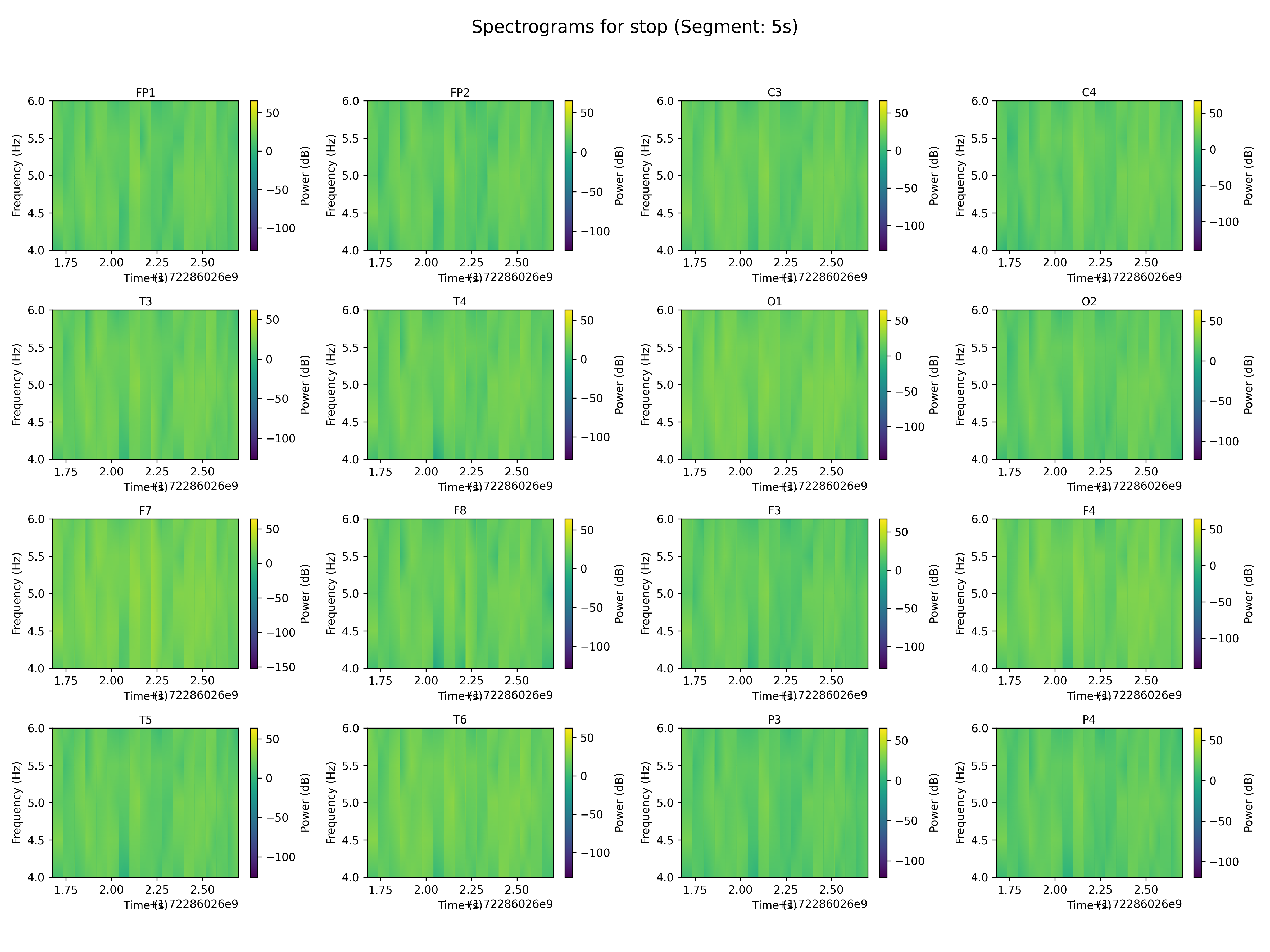 spectrogram_stop_segment_5s.png