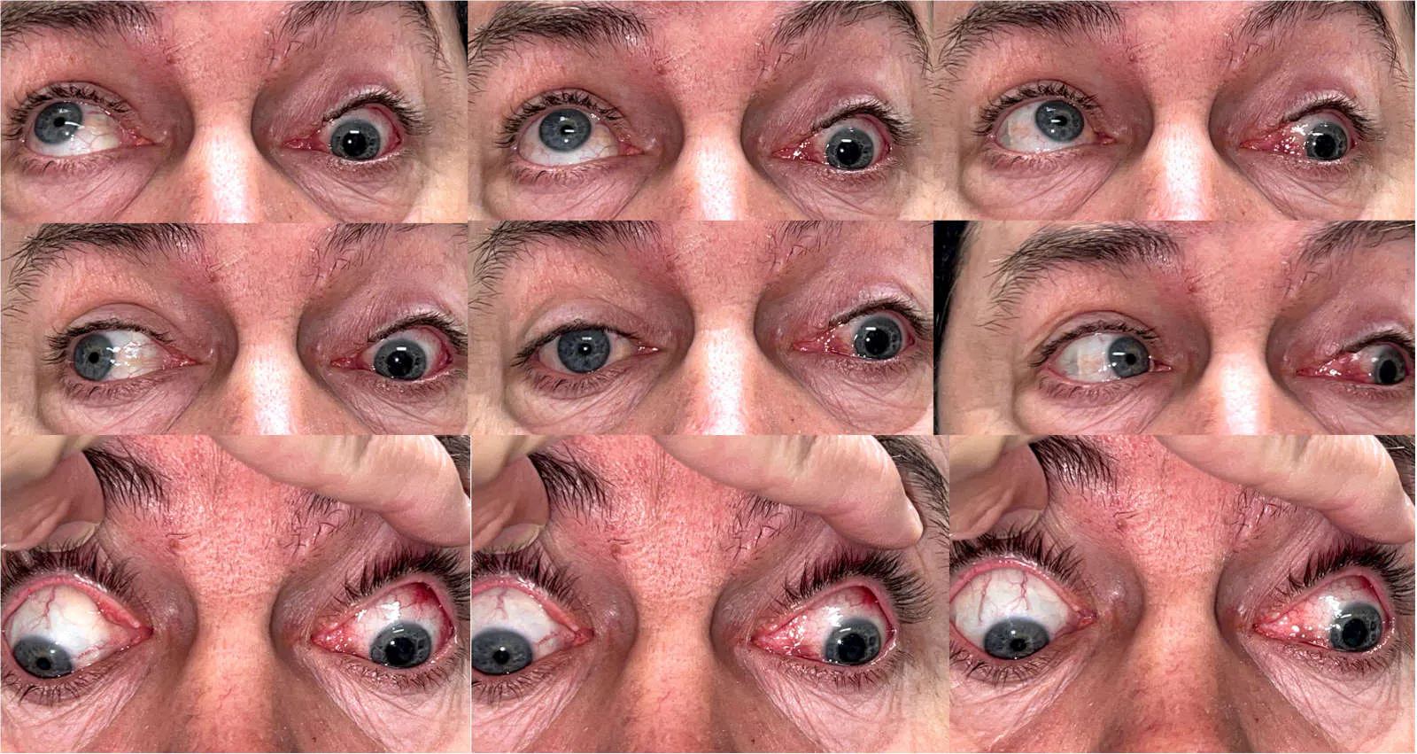 1 mes post cx.jpg