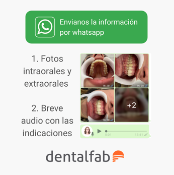 Dentalfab - Evaluación preliminar de un caso para alineadores.png