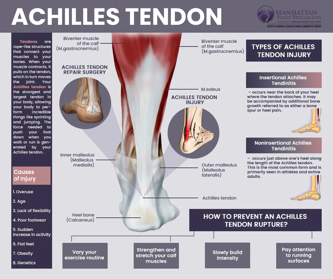 Achilles Tendon.jpg