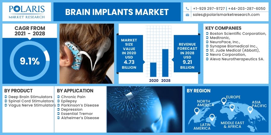 Brain Implants Market.jpg