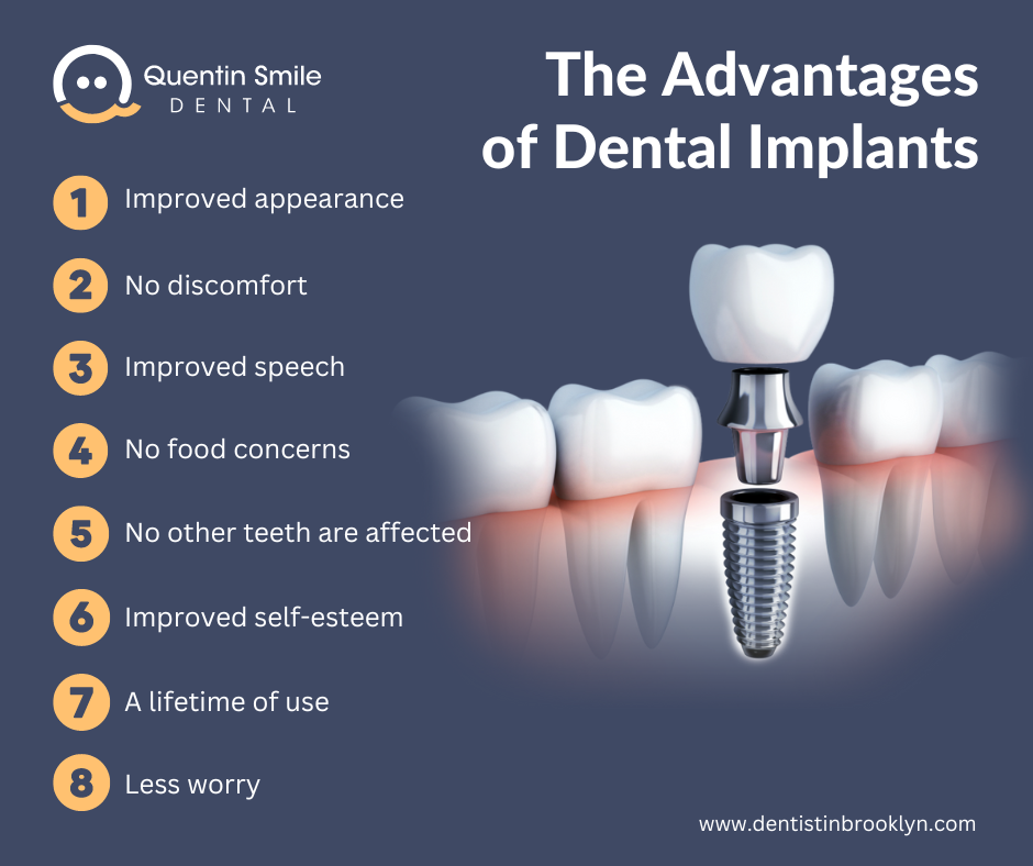 The Advantages of Dental Implants.png