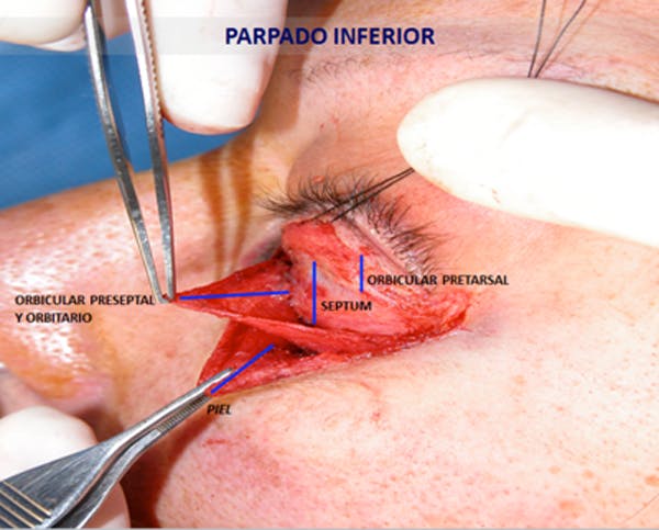 parapado inferior anatomia.jpg