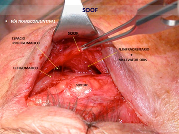 dentro dle soof .jpg
