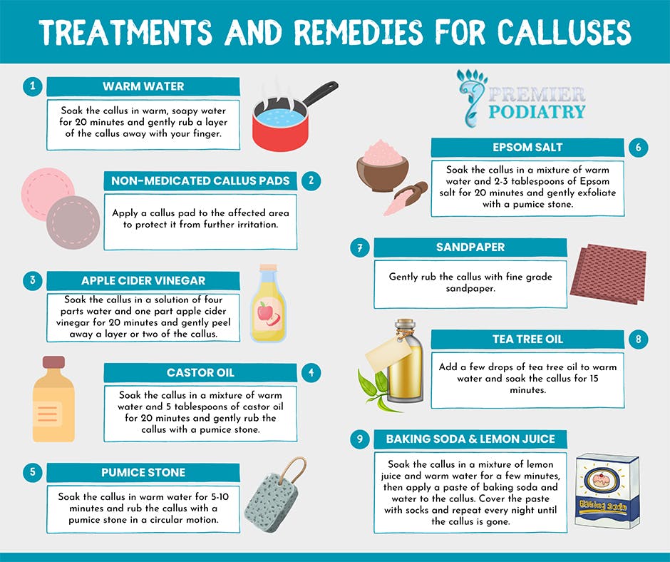 how-to-get-rid-of-calluses.jpg