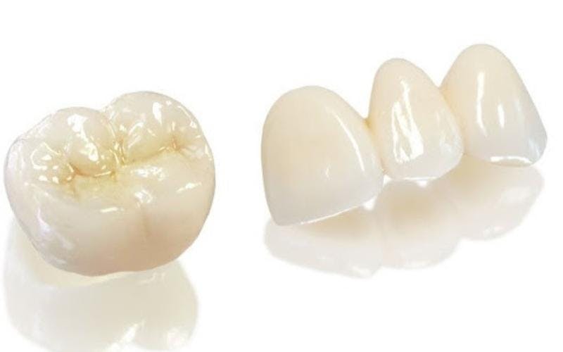 Răng sứ Zirconia được làm từ sứ nguyên khối