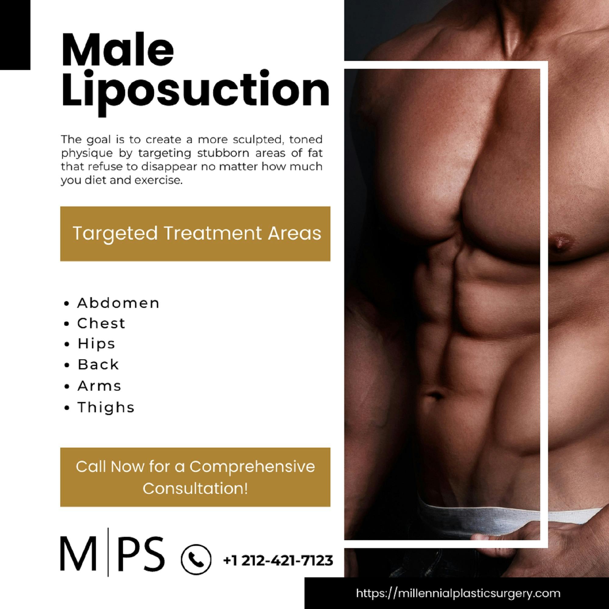 Male Liposuction – копія.jpg