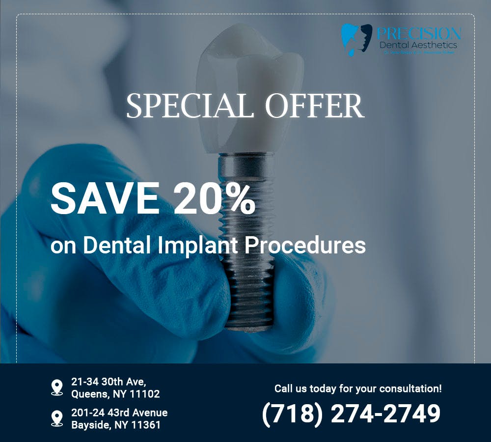 Special-Dental-Implant-Procedures.jpg