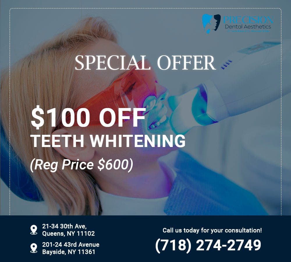 Special-Teeth-Whitening.jpg