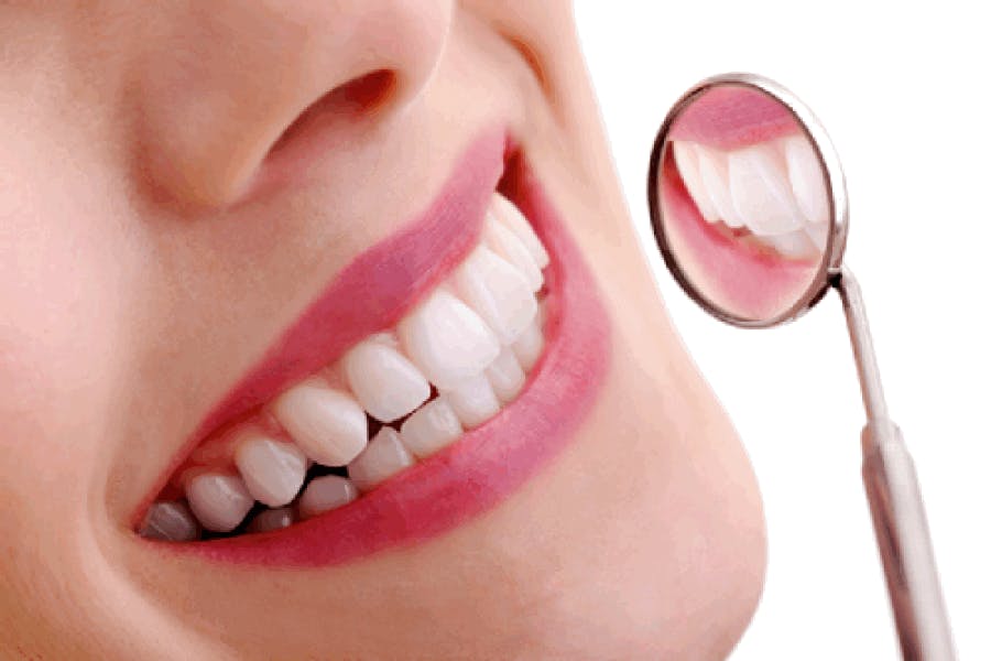 Răng sứ Titan nếu được chăm sóc đúng cách sẽ có độ bền cao