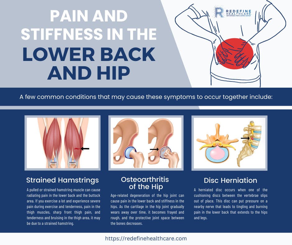 Pain and Stiffness in the Lower Back and Hip copy.jpg