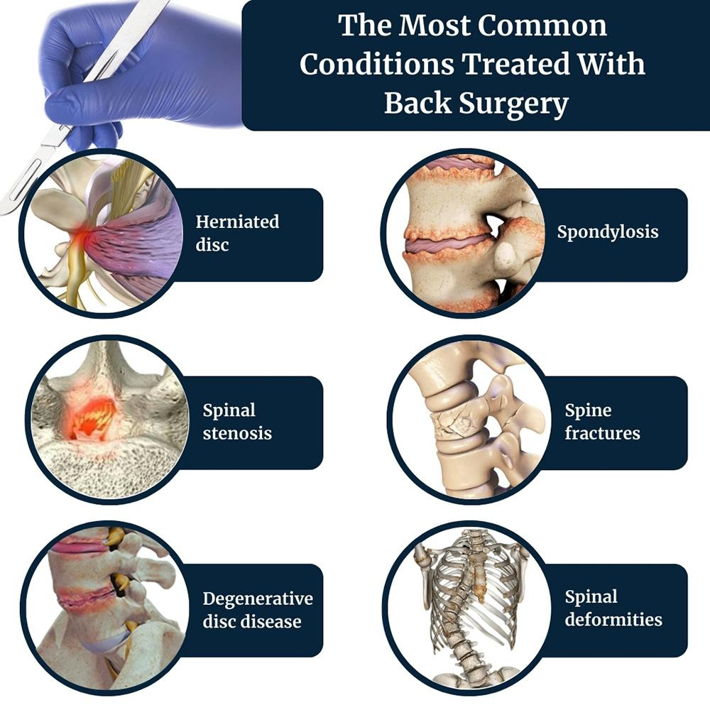 conditions-treated-with-back-surgery.jpg