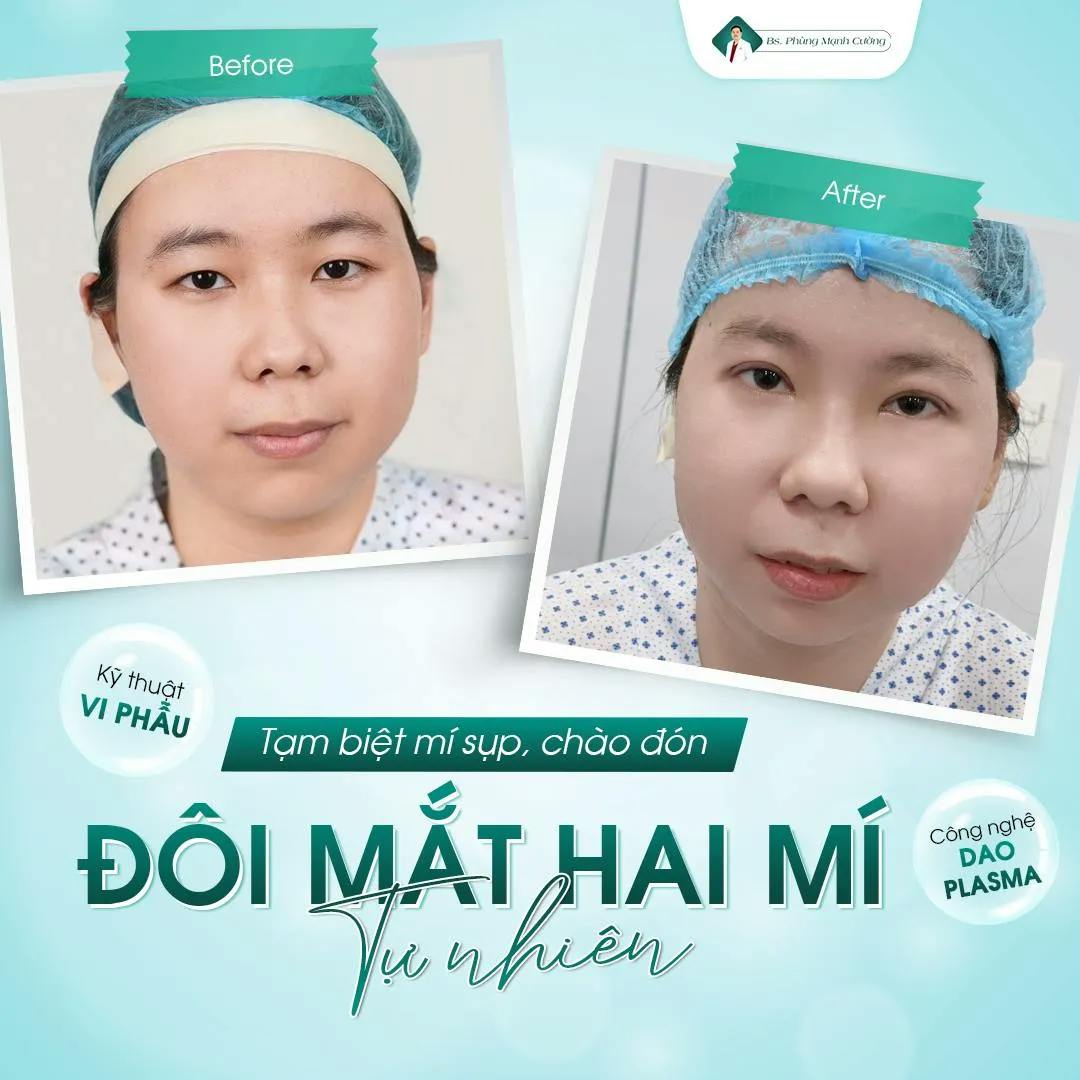 bao-nhieu-tuoi-nhan-mi-duoc.webp