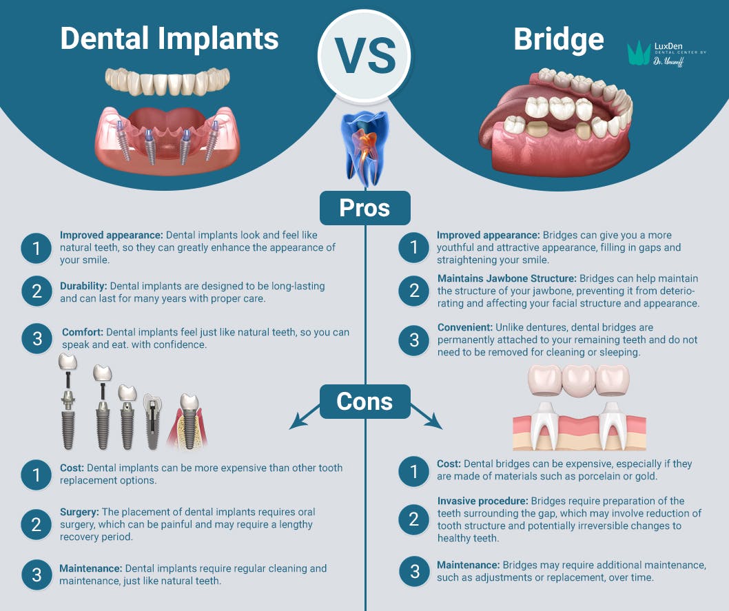 Dental implants vs dental bridge.jpg