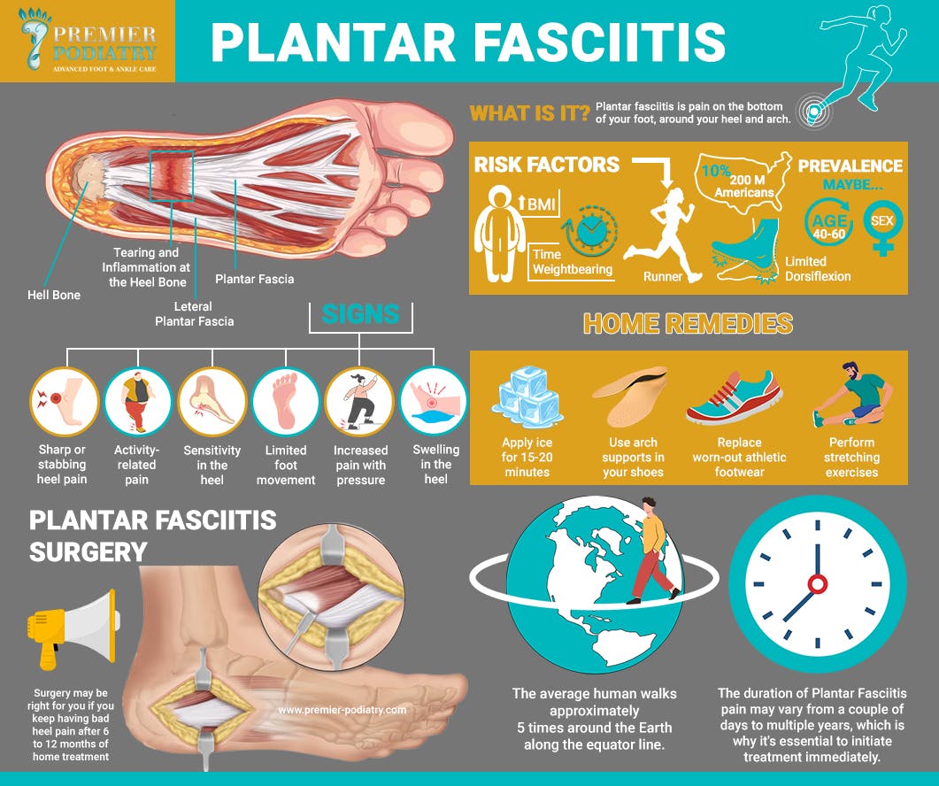 Plantar Fasciitis.jpg
