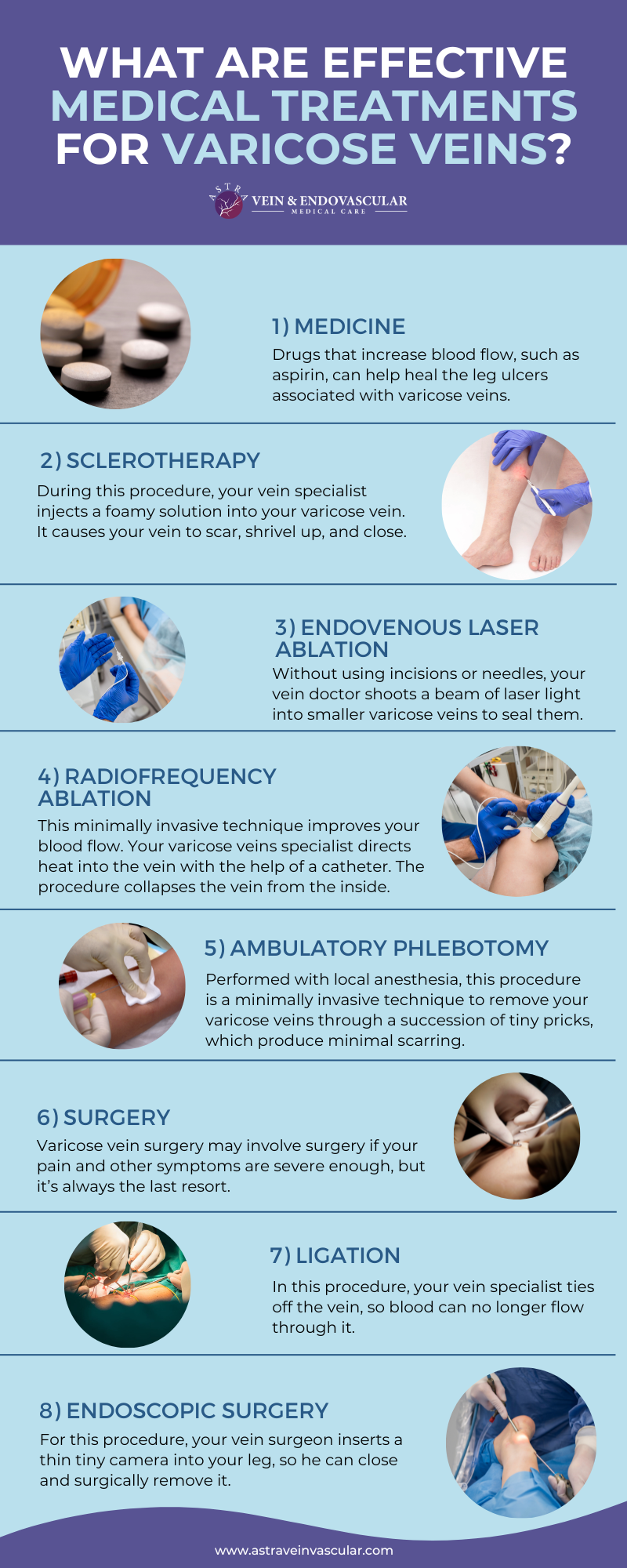 What Are Effective Medical Treatments for Varicose Veins.png