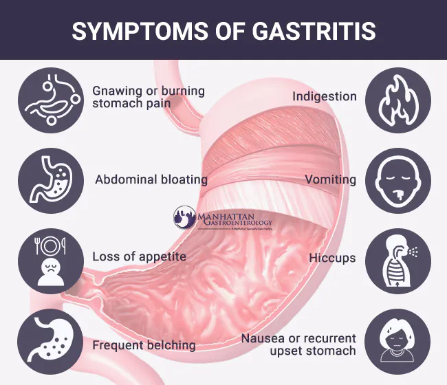 Symptoms-of-gastritis.jpg