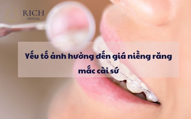 yeu-to-anh-huong-den-gia-nieng-rang-mac-cai-su