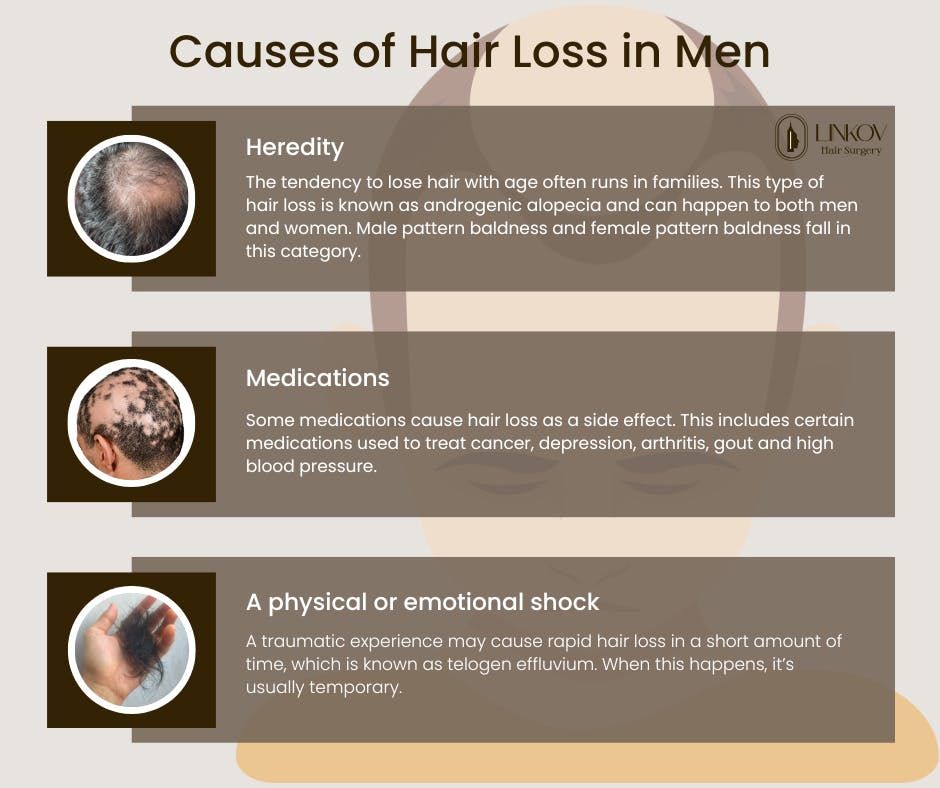сauses-of-hair-loss-in-men.jpg