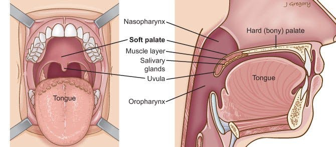 SOFT-PALATE-ADAMMUZIC.jpg