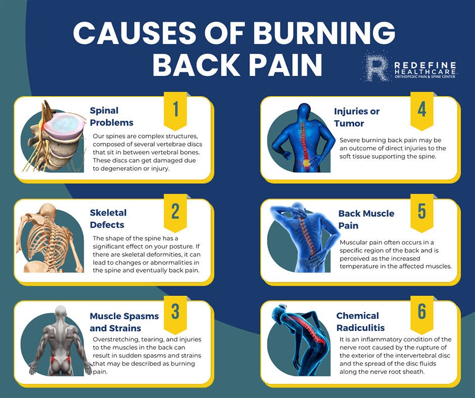 What Causes Burning Back Pain1.jpg