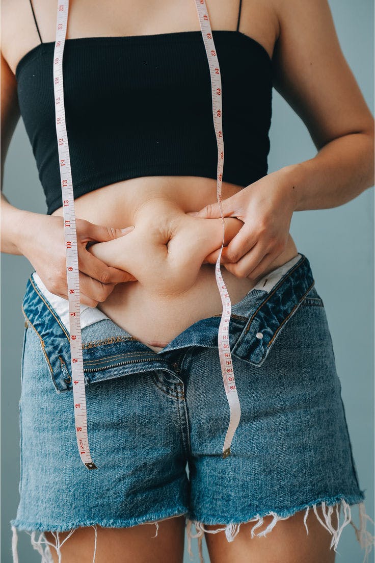 Liposuction in Islamabad.jpg