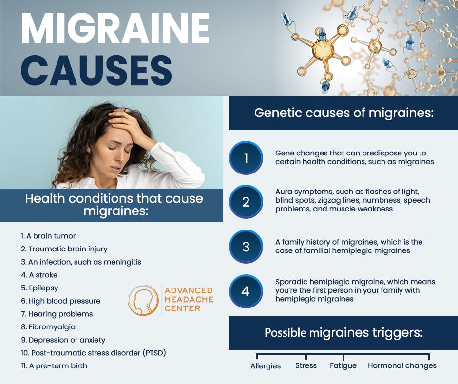 Migraine Causes.jpg