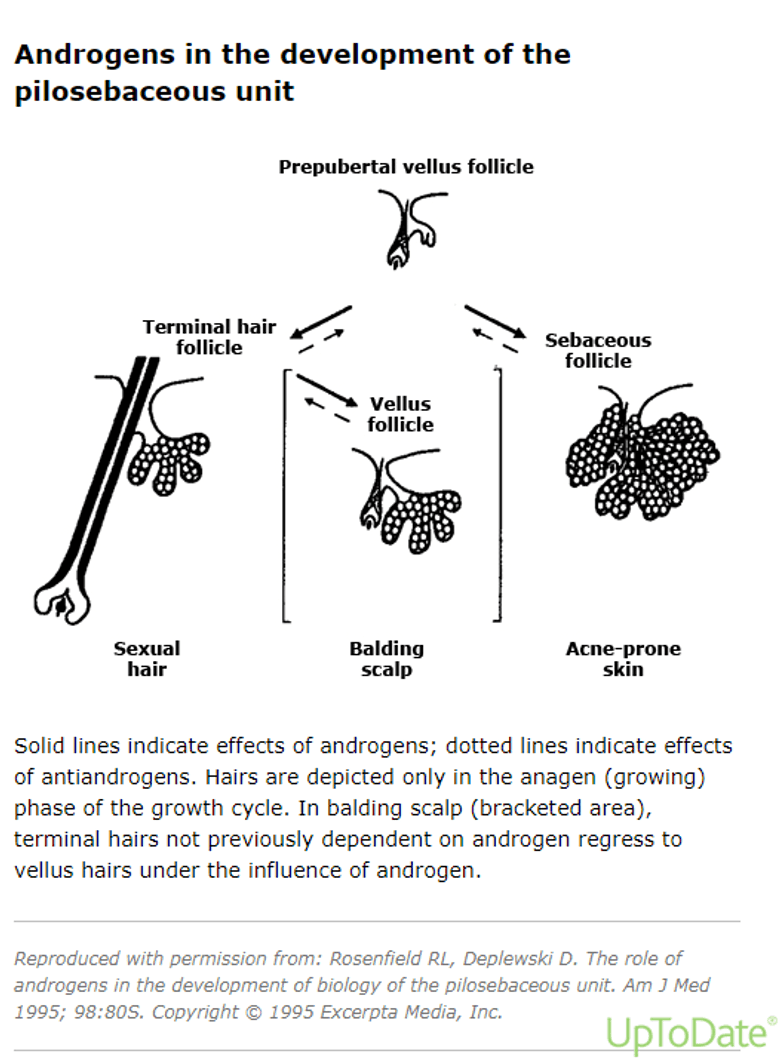 Pathophysiology_hirsutism.png