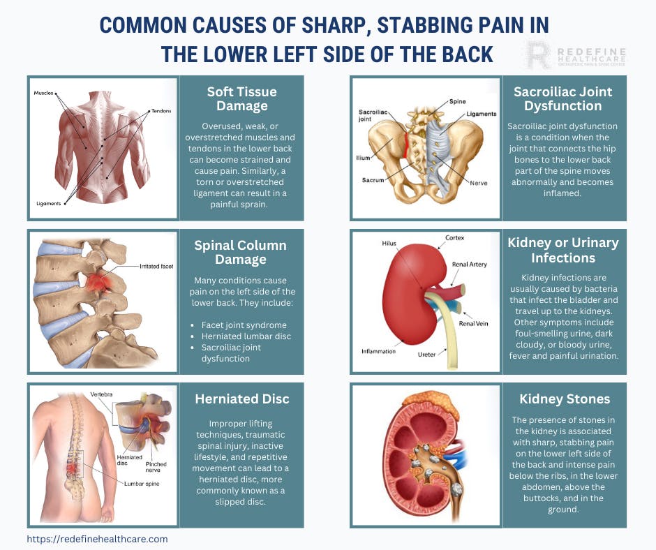 Common Causes of Sharp, Stabbing Pain in  the Lower Left Side of the Back.jpg